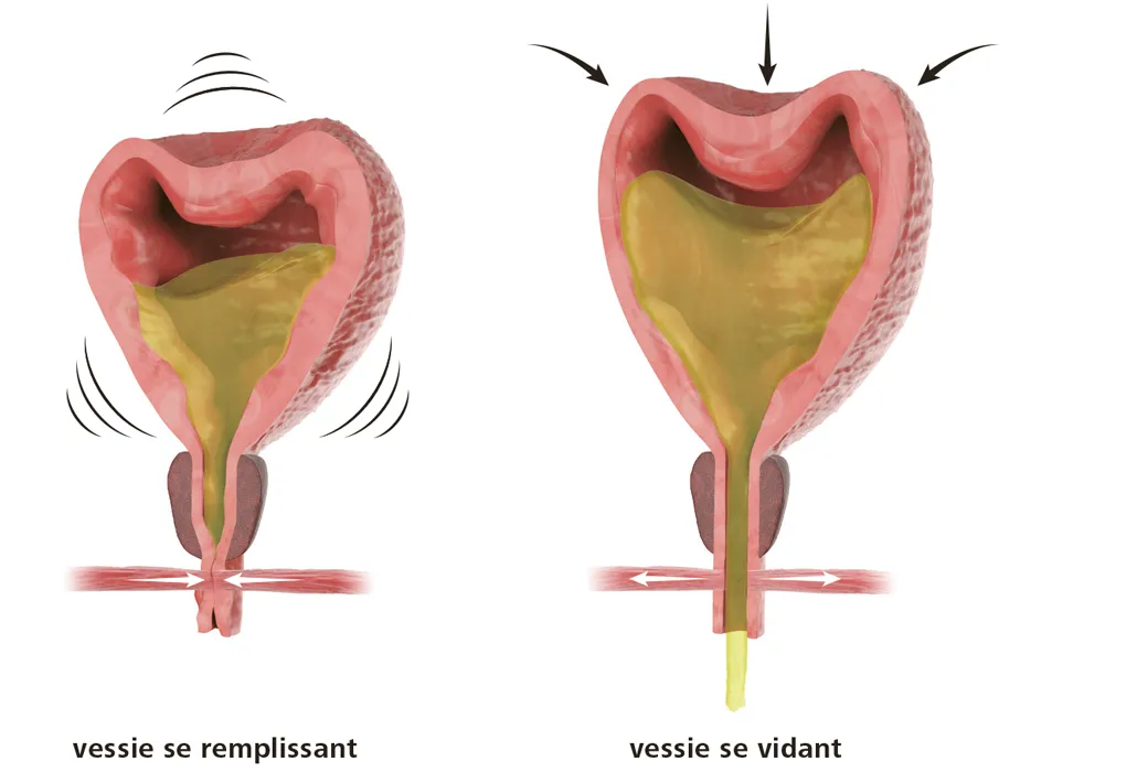 Protocole d'hydratation pour traitement avec la vessie pleine