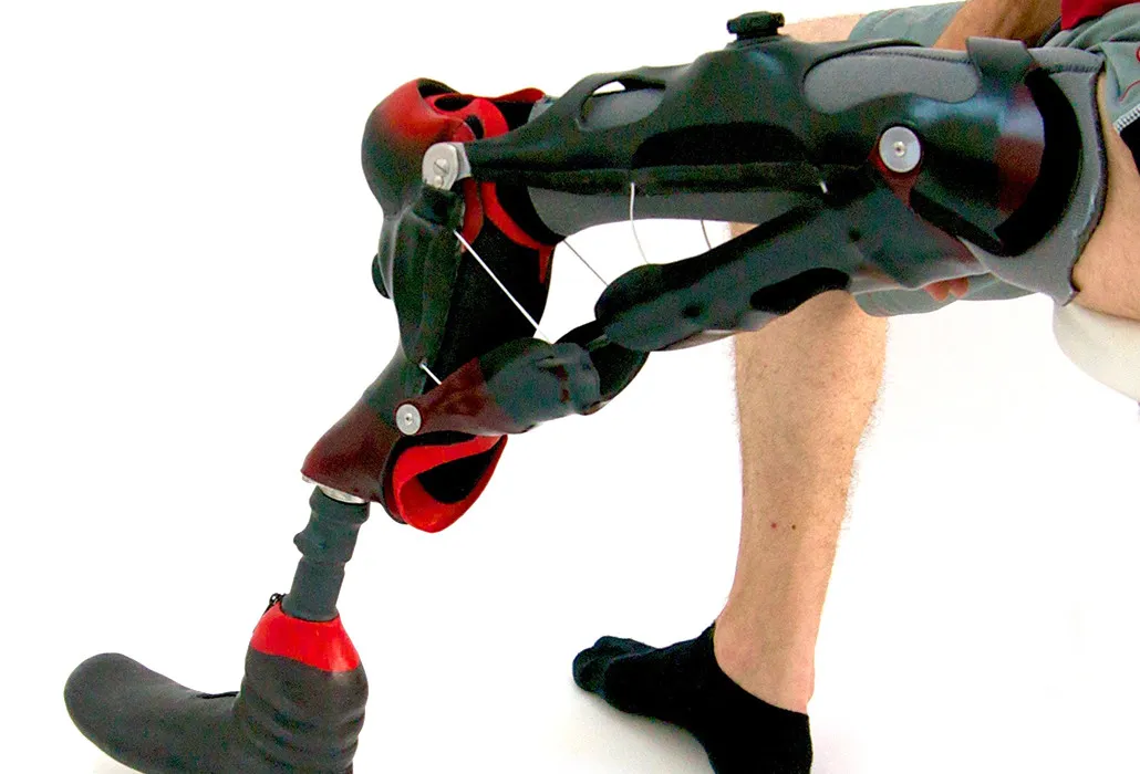 Orthotec Orthopädietechnik Orthoprothesen Massanfertiung Umdrehplastik am Bein
