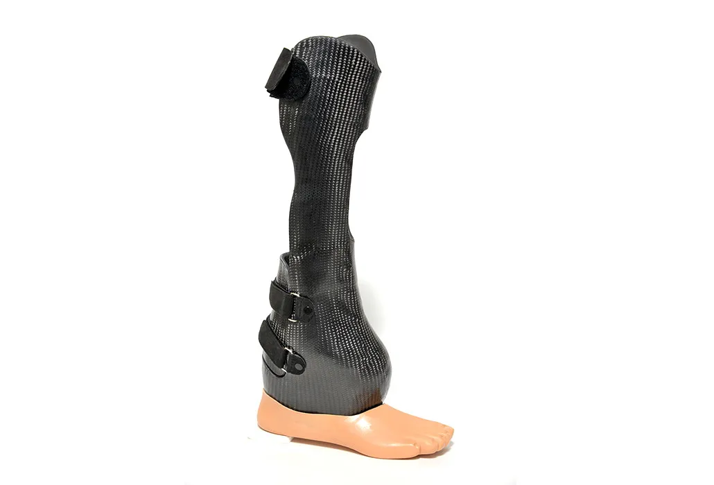 Orthotec Orthopädietechnik Prothesen Massanfertiung Vorfussprothese extra stabil