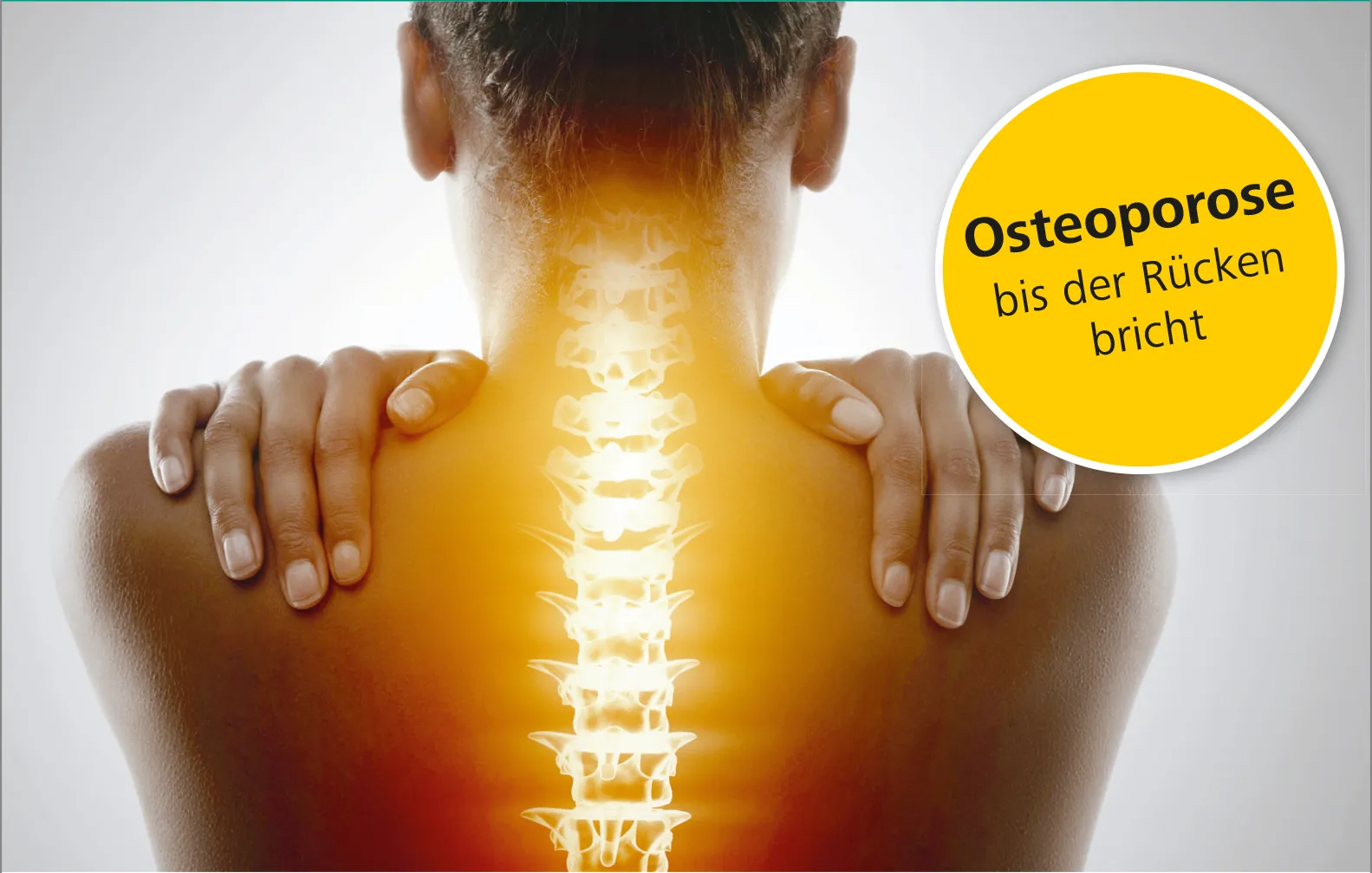 Rückenforum "Osteoporose: bis der Rücken bricht": Schweizer Paraplegiker Zentrum am 18. März 2020